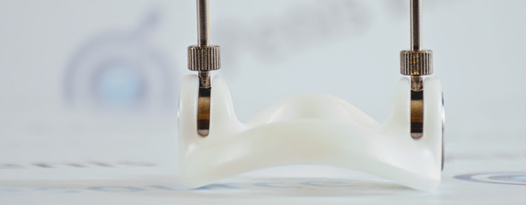 SizeGenetics 1mm Gap